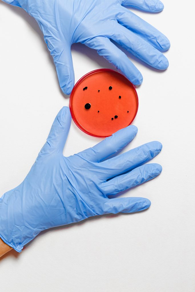 person in blue gloves holding petri dish